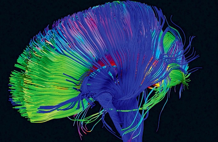 Neural-pathways-in-the-brain.jpg