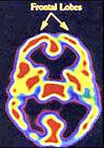 brain04.jpg