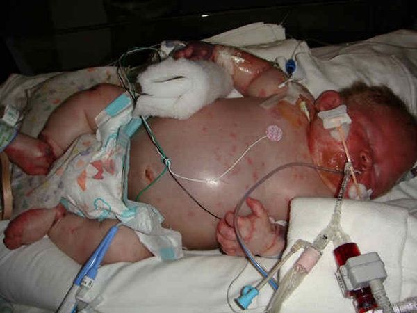 At-Birth-Hepatitis-B-Vaccination.jpg