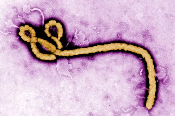 The-Ebola-virus.jpg