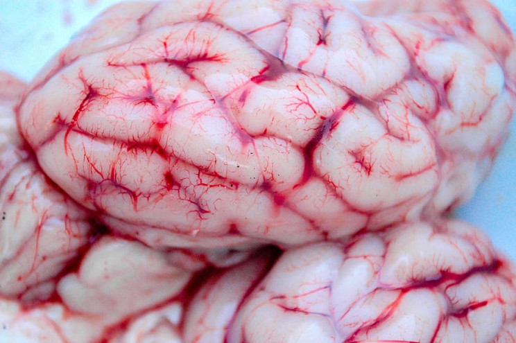 brain-neurology-spirit-anatomy_resize_md.jpg
